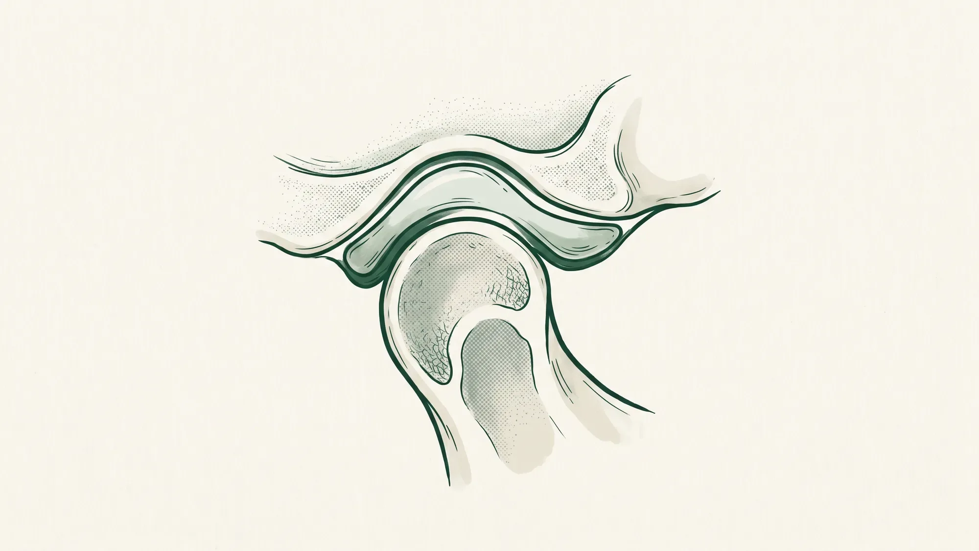Illustration of the temporomandibular joint showing the jaw joint and articular disc