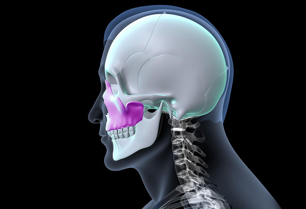 Joint Replacement – Custom Prostheses